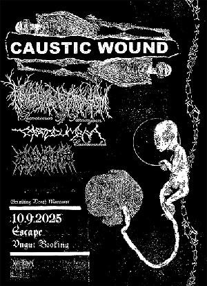 Caustic Wound, Reverence To Paroxysm, Castleumbra, Backyard
